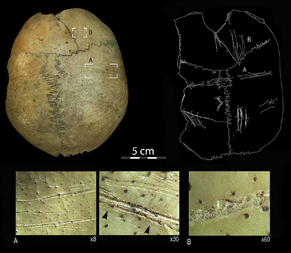 Estudio tafonómico de las marcas dejadas por la práctica del canibalismo en restos encontrados en la Cueva de El Toro (Málaga). Del twitter de F. Marginedes; @Cesc_Marginedas.